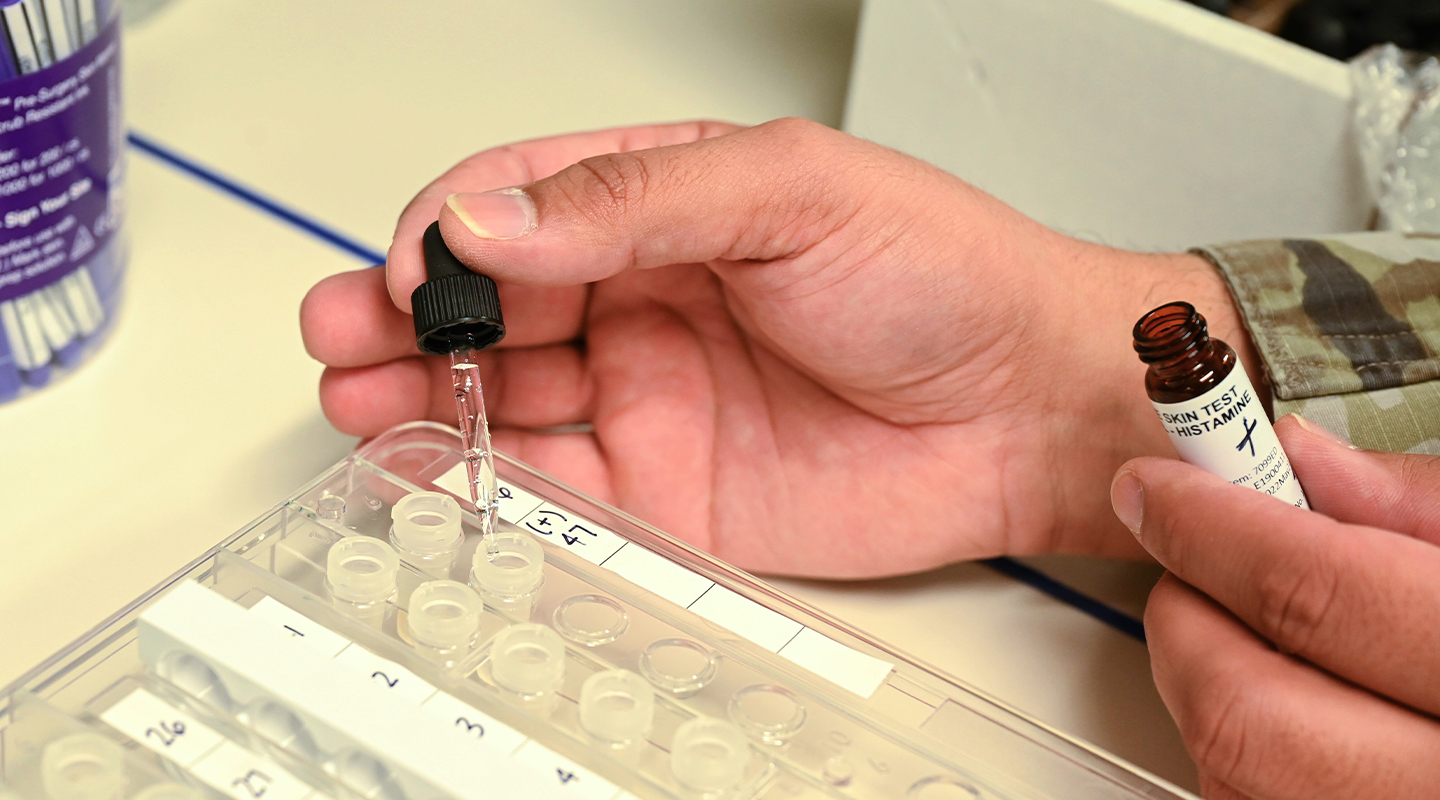 allergist conducting allergen testing